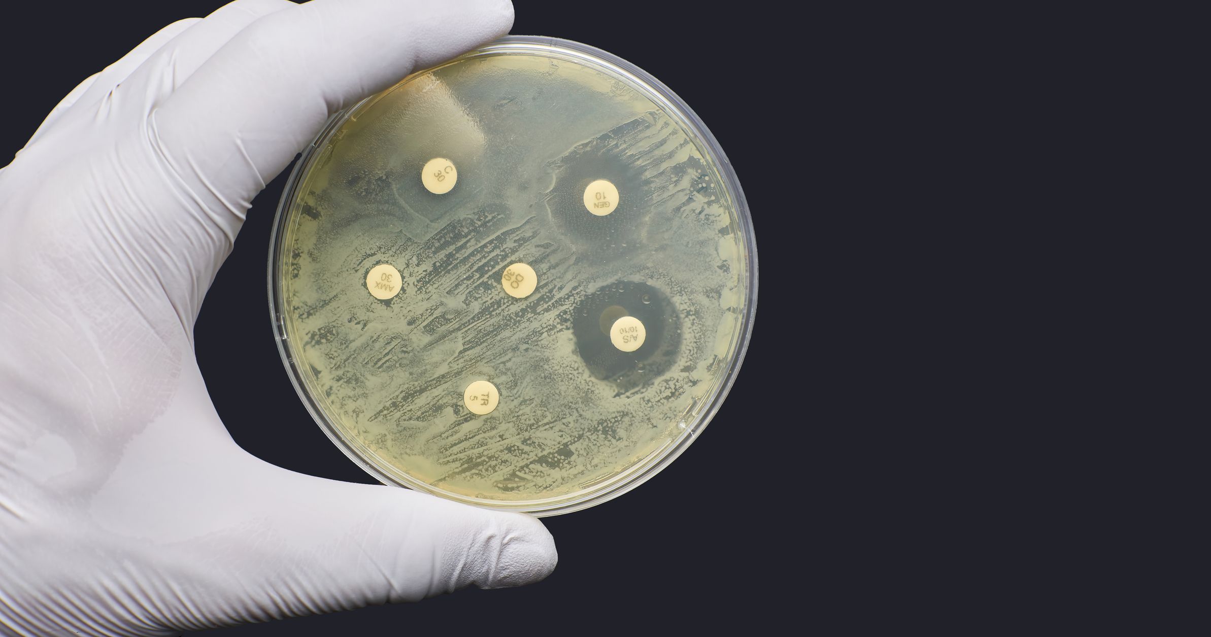 A petri dish with drug resistant bacteria on it